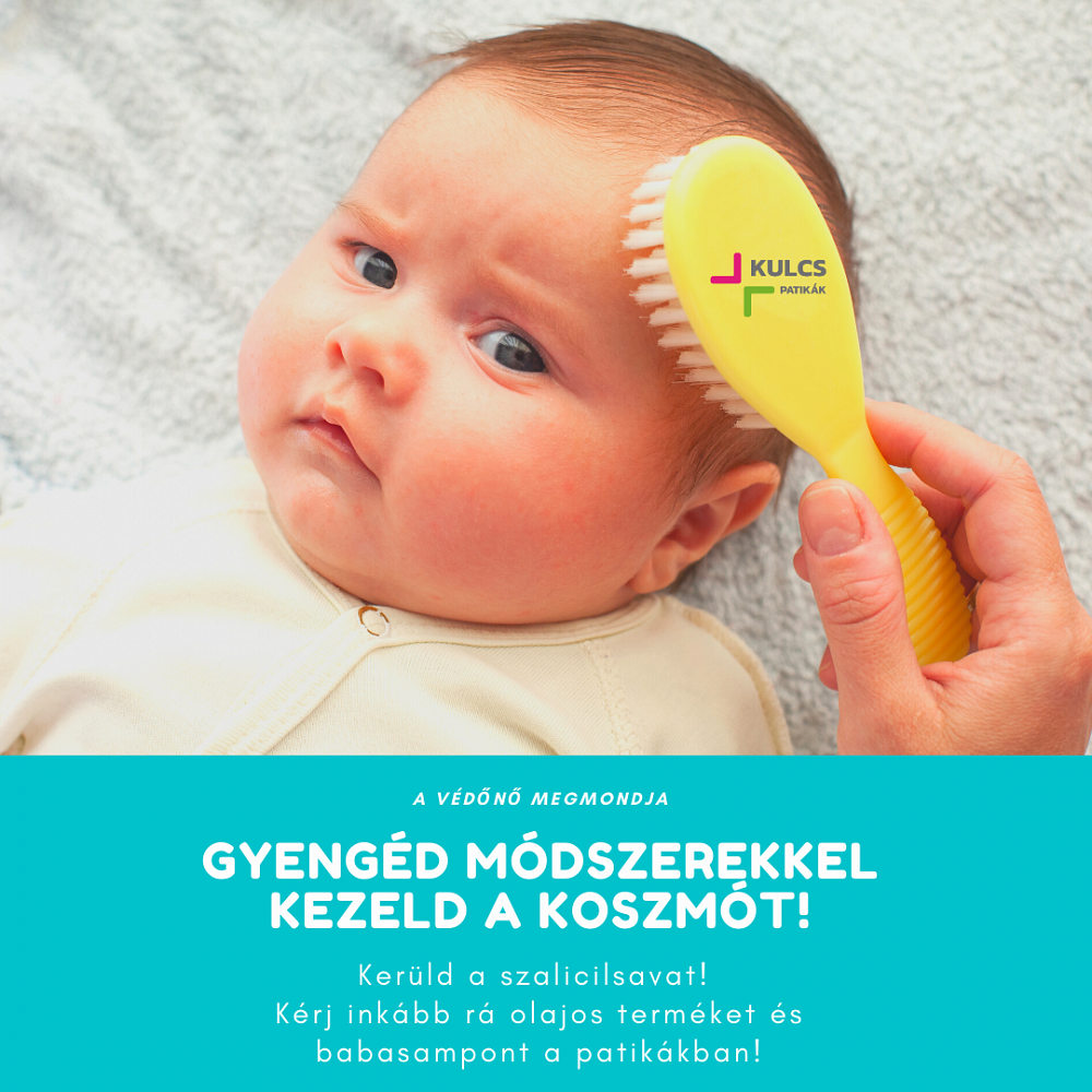 Olajokkal vagy tisztítókendőkkel is ápolni tudjuk a baba fejbőrét Olajokkal vagy tisztítókendőkkel is ápolni tudjuk a baba fejbőrét